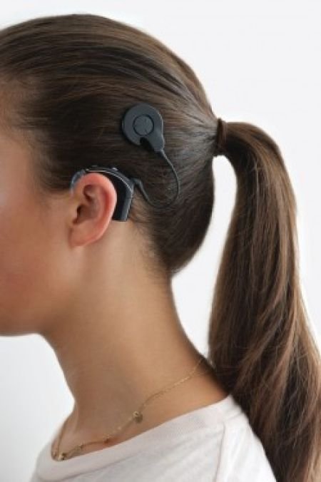 1967 - ..: Invention of the Cochlear Implant by Graeme Clark