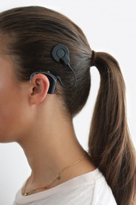 1967 - ..: Invention of the Cochlear Implant by Graeme Clark